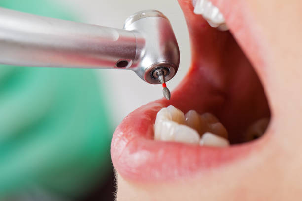Best Root Canal Emergency Dentist  in White Oak, OH